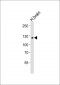 AMPH Antibody